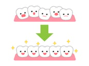 歯並びイラスト