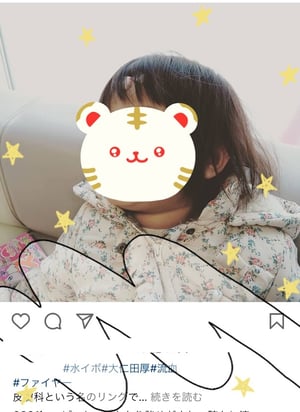 排便障がいについて